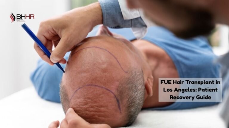 fue hair transplant los angeles