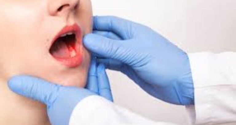 oral cancer treatment image