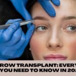 eyebrow transplant